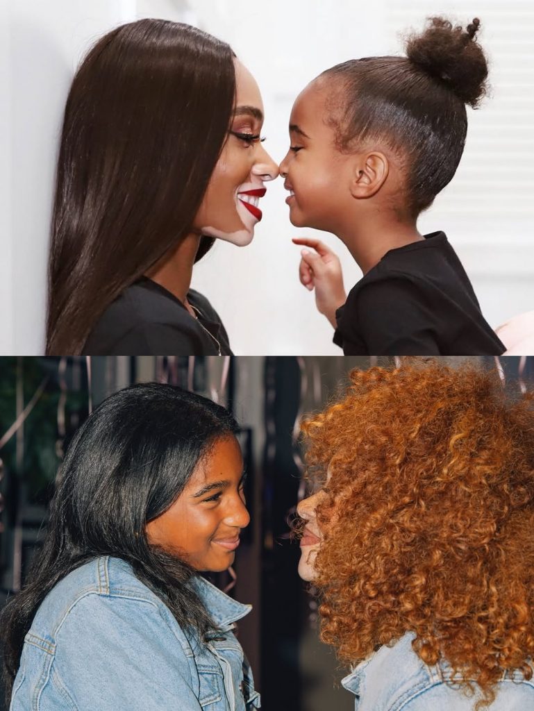 A photo collage showing Sami’s journey from a little girl to the young lady she is now, with Winnie by her side through it all. Picture: Instagram@WinnieHarlow